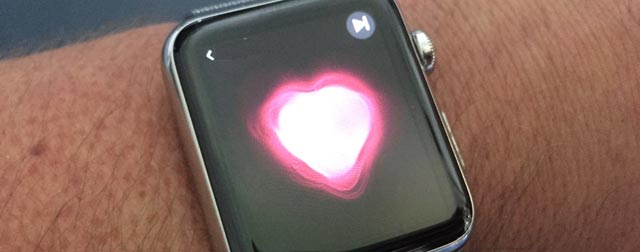 Nach Update Apple Watch Mit Aussetzern Bei Der Herzfrequenzmessung Iphone Ticker De